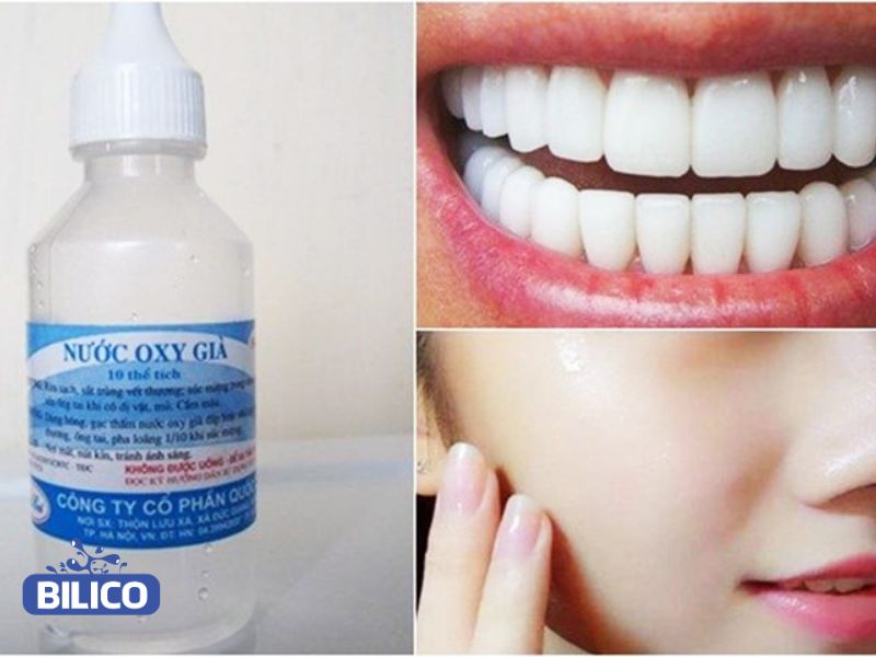 Hydrogen peroxide giúp làm trắng răng, trị mụn